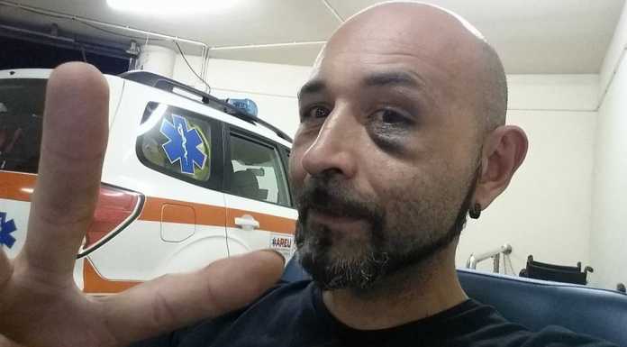 Picchiato al parco, mette le foto sul web. “Ragazzi, non reagite”