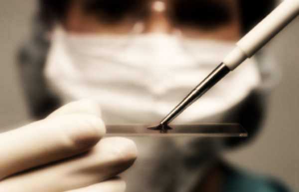 Epatite e nuovi farmaci: importante studio degli esperti lecchesi