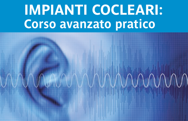 Tecnica di impianto cocleare a G.B. Mangioni Hospital