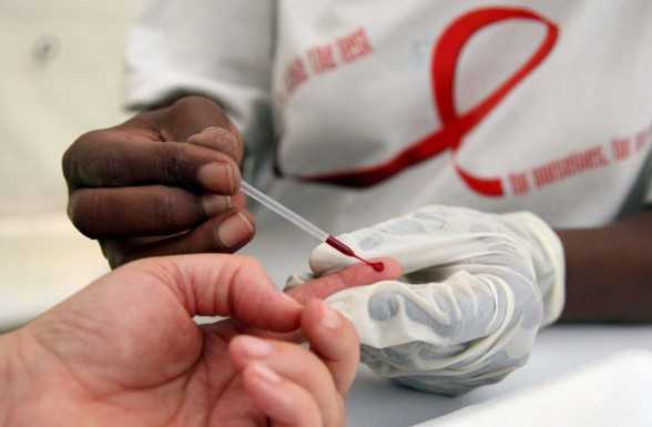 HIV: Lecco prima in Lombardia per contagi, giornata di prevenzione