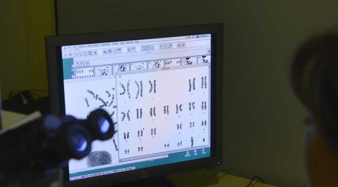 Ist.Medea, individuato fenomeno genetico descritto finora solo nel cancro