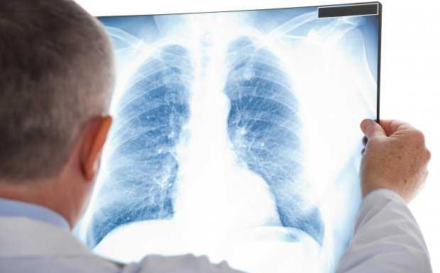 Sanità. Pneumologia, a Merate accordo tra ospedale e Inrca