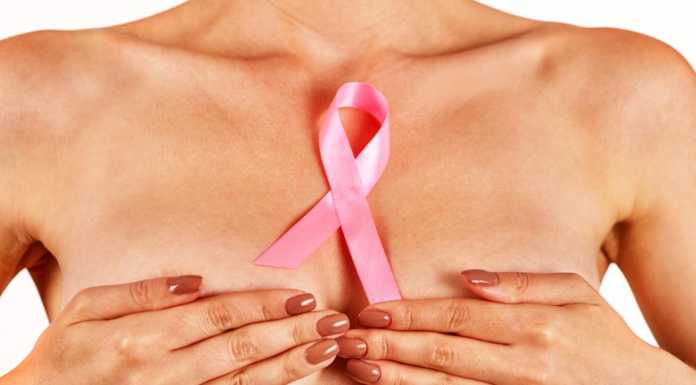 Fisio Online. Tumore al seno: fisioterapia, esercizio e prevenzione