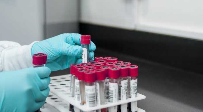 Coronavirus: nuovi casi in ospedale, tanti ‘tamponi’ e reparti al limite