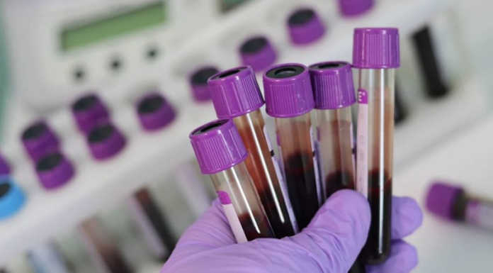 Test sierologici, ATS: “Evitate iniziative autonome” altrimenti il tampone ‘slitta’