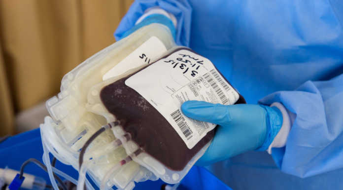 Avis Lombardia con Anci per sensibilizzare alla donazione di plasma sacca sangue