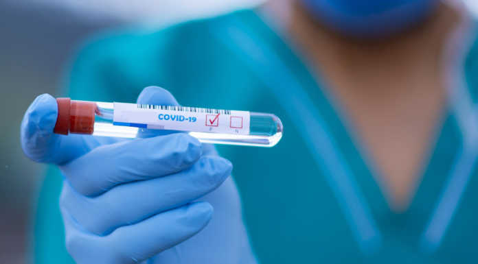 Covid. Sono 2.366 i nuovi positivi in Lombardia (14%), +90 nel Lecchese