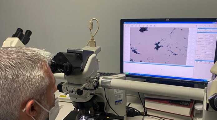 Prevenzione dell’Hpv, Asst Lecco organizza una giornata di Screening