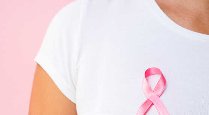 Tumore al seno metastatico. A Bulciago un incontro sulle terapie integrate con Agatha in Cammino tumore al seno in salus