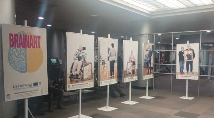 La mostra “Brainart” fa tappa all’ospedale Manzoni di Lecco breinart