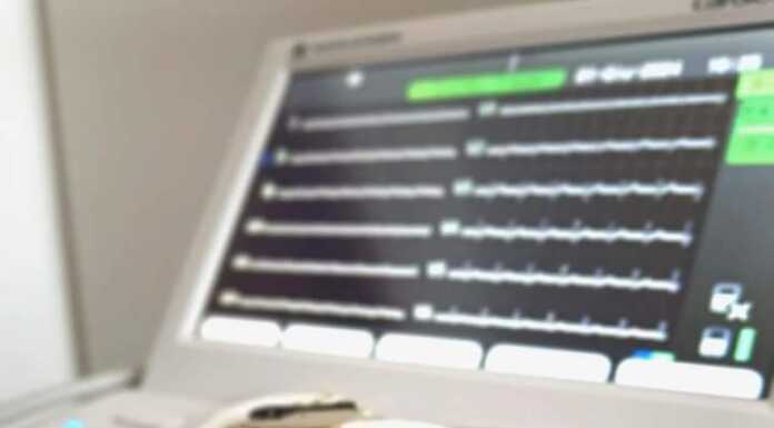 Bosisio: oltre 150 elettrocardiogrammi nella giornata della prevenzione cardiovascolare elettrocardiogramma