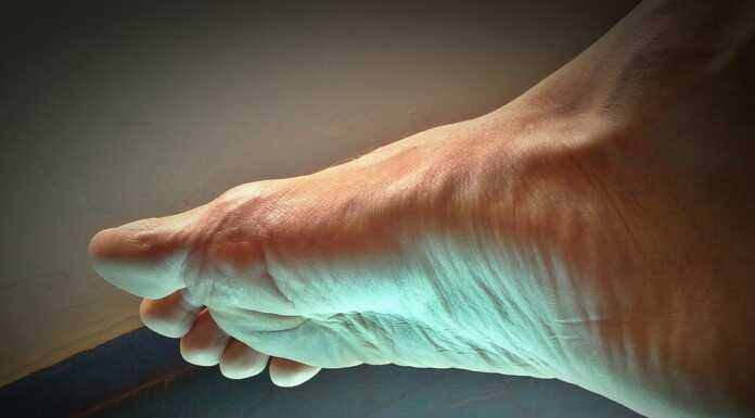 Tendinite del tibiale posteriore: come riconoscerla e curarla