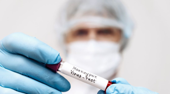 Vaiolo Scimmie, Bertolaso: “Nessun caso in Lombardia con variante di tipo I”