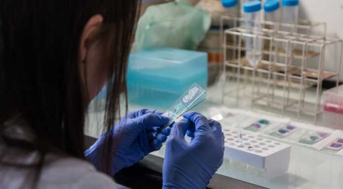 Malattie sessuali in aumento tra i giovani, nel 2024 già 17 casi di Hiv nel lecchese