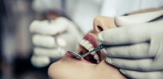 Allineatori trasparenti e odontoplastica: un binomio vincente Dentists treat patients' teeth.