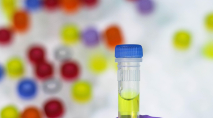 Molteno ospita il Prof. Silvio Garattini: una serata dedicata a ricerca e prevenzione (Image by Belova59 from Pixabay)